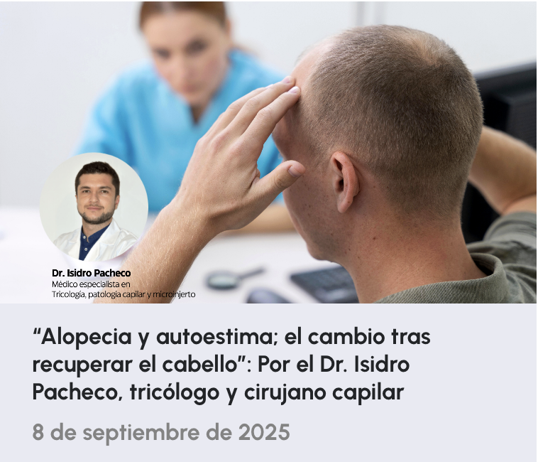 alopecia y autoestima